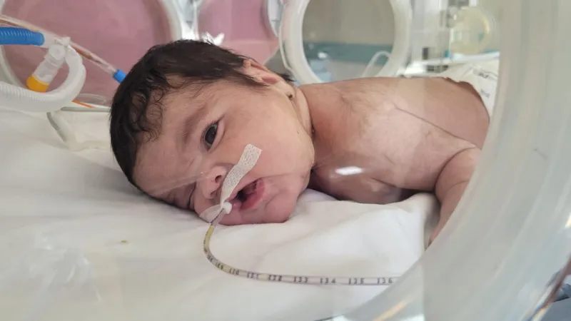 Kütahya'da Mucize! Bebek Boynundaki Tümörden Kurtuldu