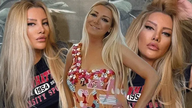 Sevenleri tanımakta zorlandı! Estetik operasyonundan 13 gün sonra...